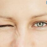 Mắt trái giật ở nữ: Nguyên nhân, ý nghĩa và cách khắc phục